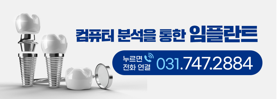 컴퓨터 분석을 통한 임플란트