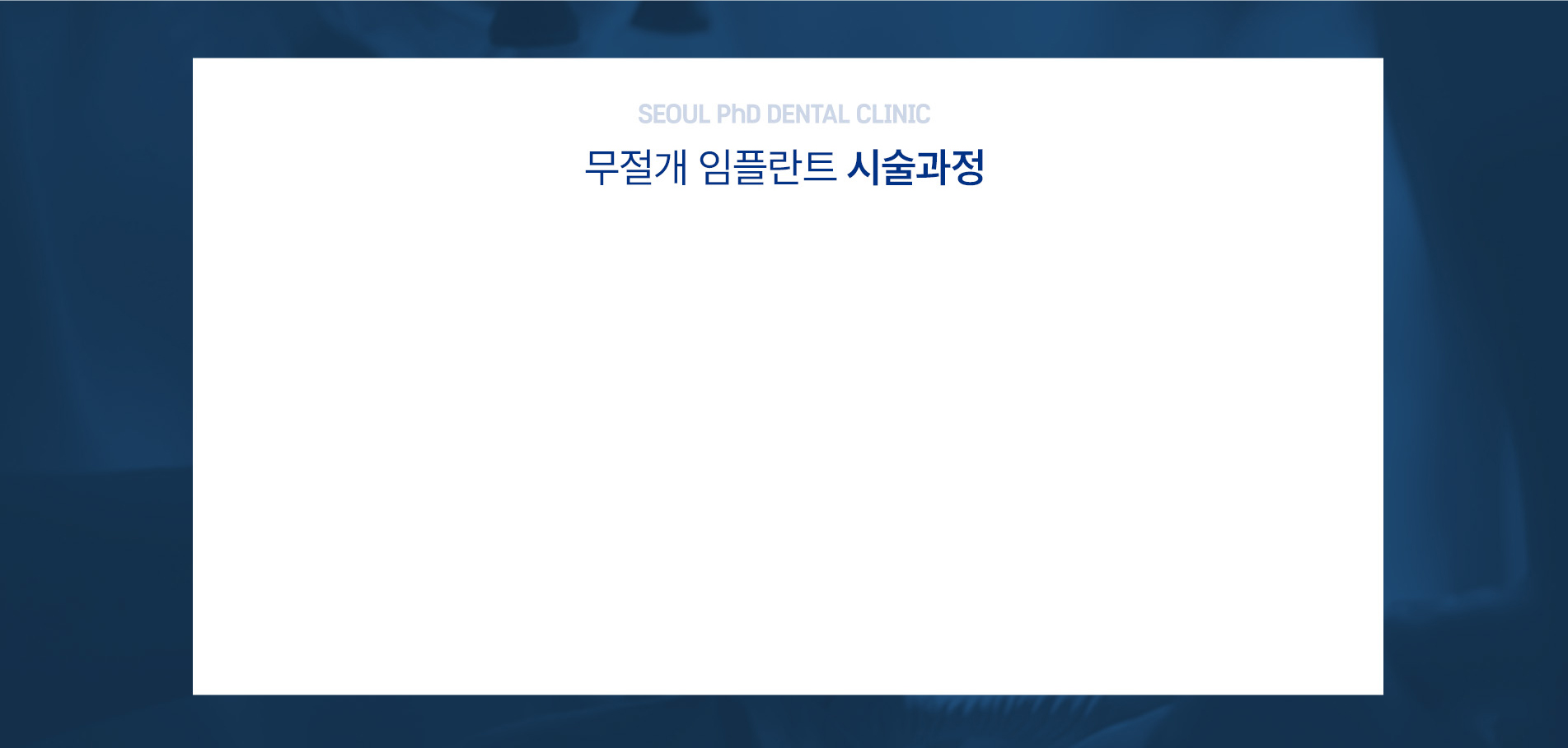 컴퓨터 분석을 이용한 임플란트 시술과정