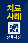치료사례